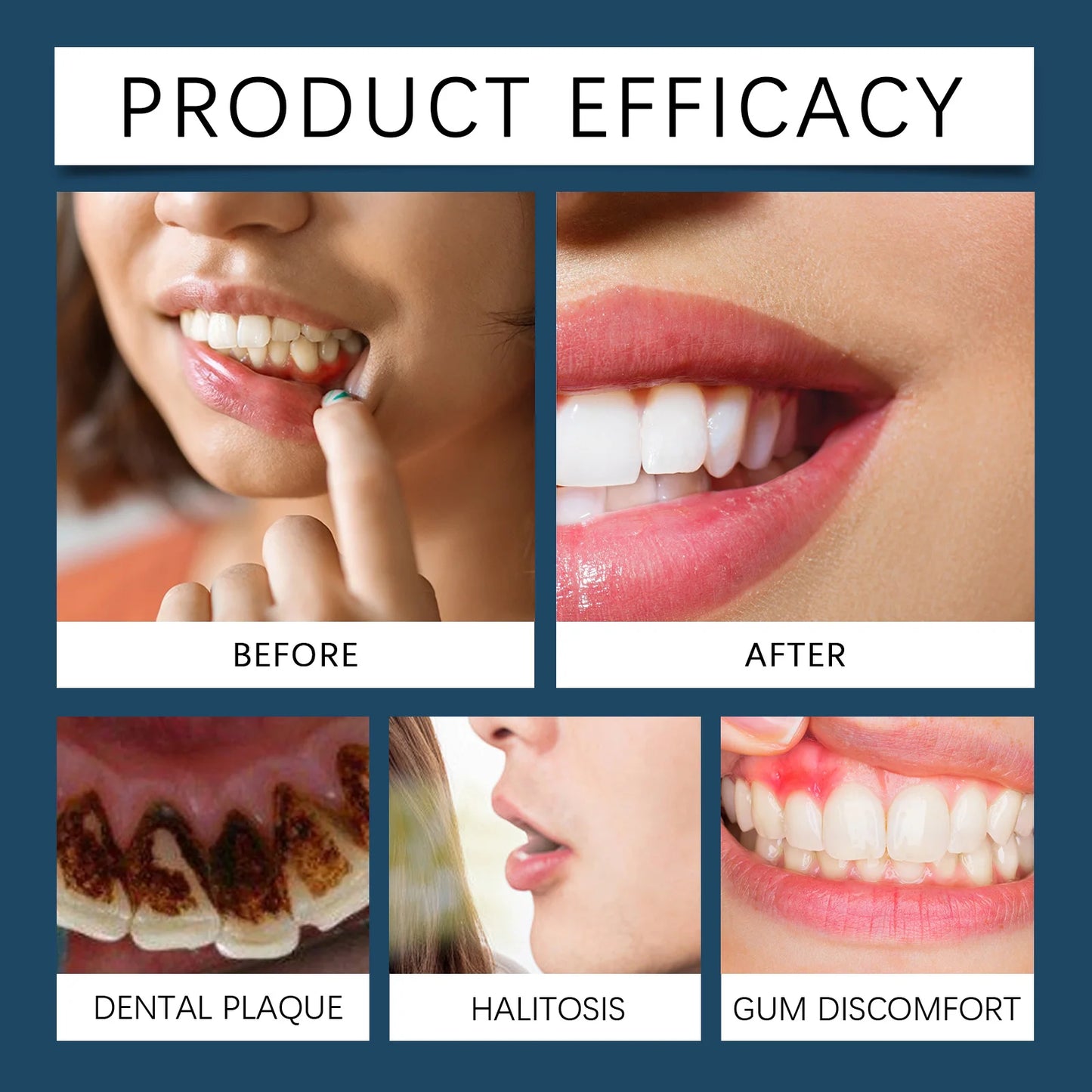 Gel Réparateur Gencives Sensibilité Dentaire