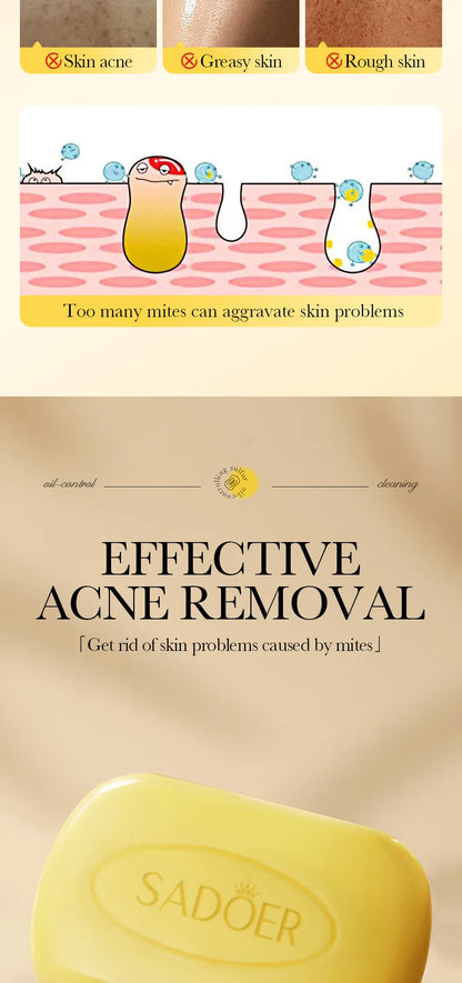 Savon Soufre SADOER Anti-Acariens Visage & Corps - Nettoyant Hydratant Artisanal