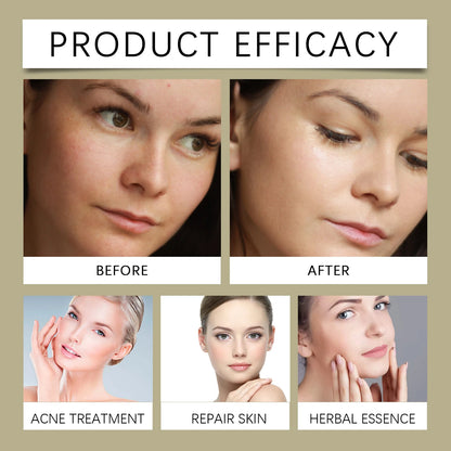 Tonique Acide Glycolique 7%