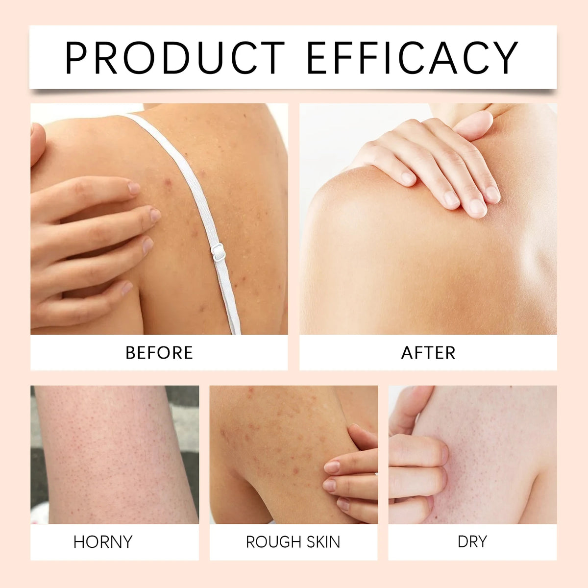 Gel Douche Éclaircissant Papaye - Exfoliant Anti-Taches Hydratant Mousse Riche