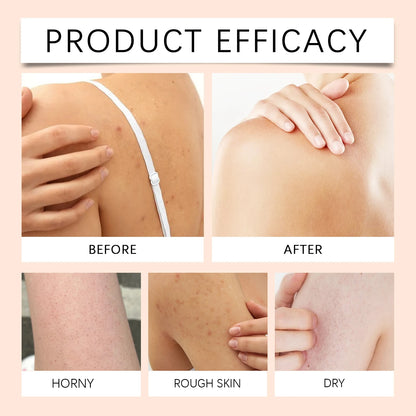 Gel Douche Éclaircissant Papaye - Exfoliant Anti-Taches Hydratant Mousse Riche