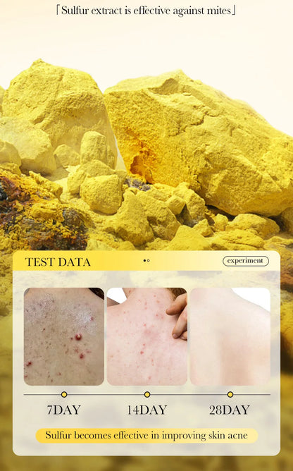 Savon Soufre SADOER Anti-Acariens Visage & Corps - Nettoyant Hydratant Artisanal