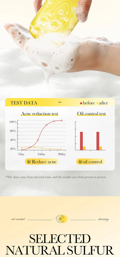 Savon Soufre SADOER Anti-Acariens Visage & Corps - Nettoyant Hydratant Artisanal