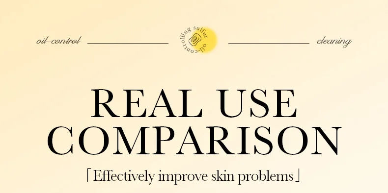 Savon Soufre SADOER Anti-Acariens Visage & Corps - Nettoyant Hydratant Artisanal