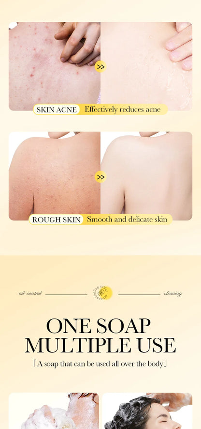 Savon Soufre SADOER Anti-Acariens Visage & Corps - Nettoyant Hydratant Artisanal